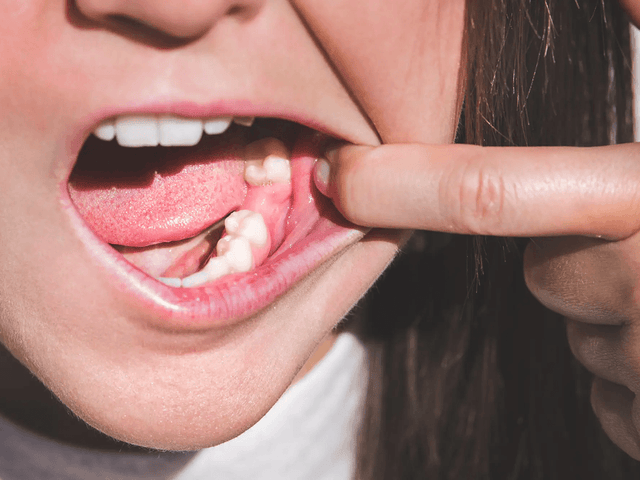 Is Tooth Regeneration Possible? What Research Really Says - Elegant Dental Laboratory
