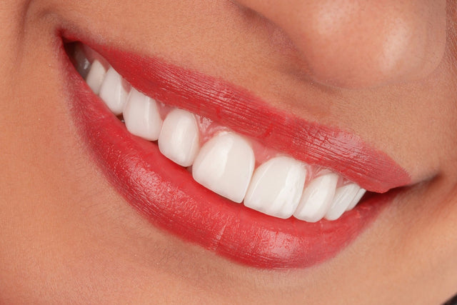 Close-up of a bright, natural smile