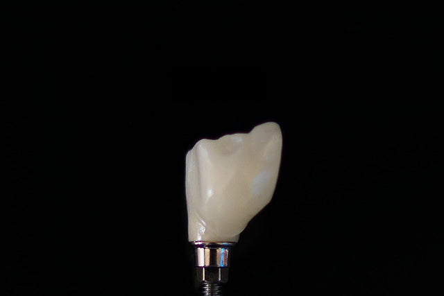 Single ceramic crown on a black background