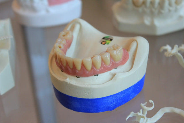 Complete denture on a dental model