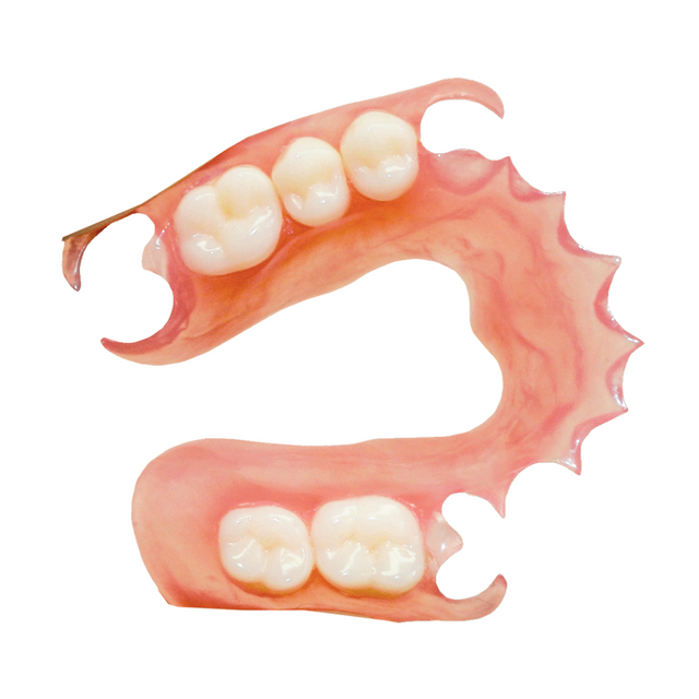 Acrylic partial denture replacing posterior teeth