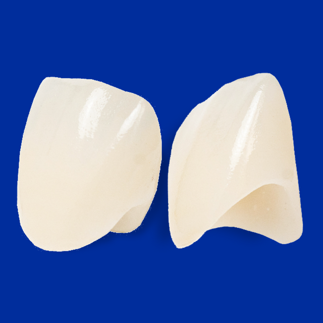 Two IPS e.max anterior crowns