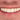 Zirconia Teeth: Pros, Cons, Best Uses, and How They Compare - Elegant Dental Laboratory
