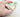 Hand holding a lower jaw model with implant attachments for an overdenture