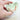 Hand holding a lower jaw model with implant attachments for an overdenture