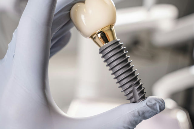 Gloved hand holding a dental implant with its crown