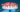 Upper complete denture with natural-looking anterior teeth, made in our Brooklyn lab