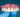 Upper complete denture with natural-looking anterior teeth, made in our Brooklyn lab