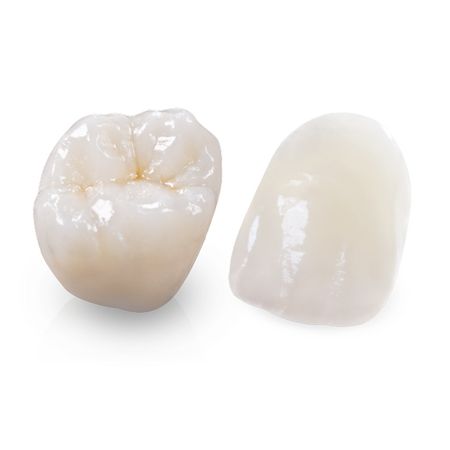 IPS e.max full-contour posterior and anterior crowns