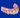Screw-retained full-arch implant prosthesis